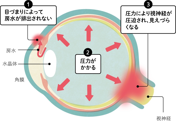 原因は？