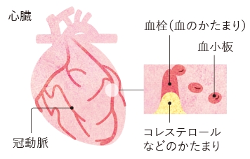 詳しく教えてください